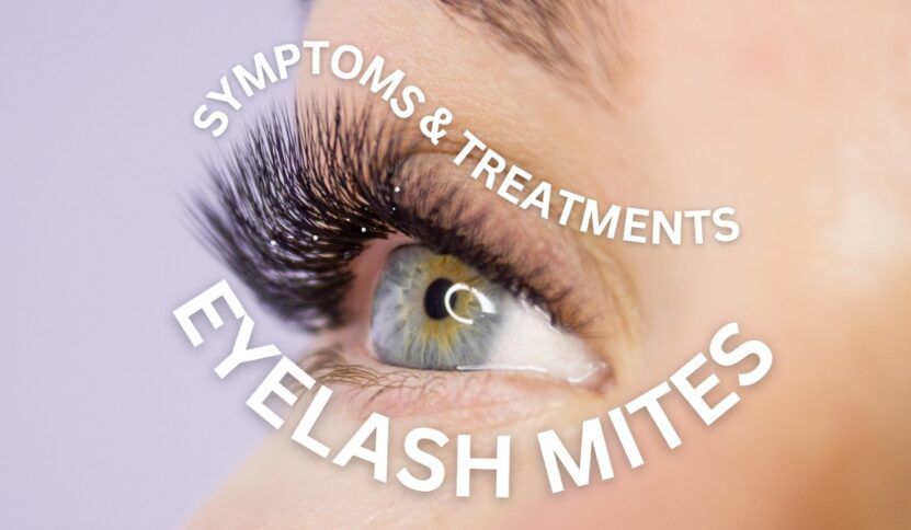 Eyelash Mites Causes and Treatments